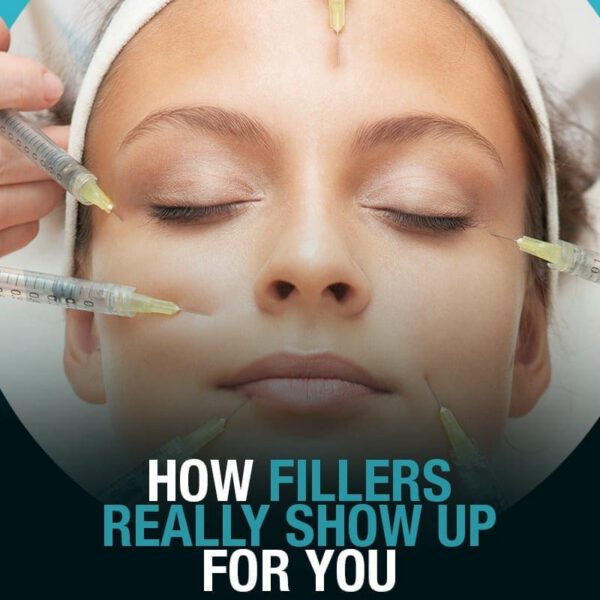 How Fillers Really Show Up For You [Infographic]