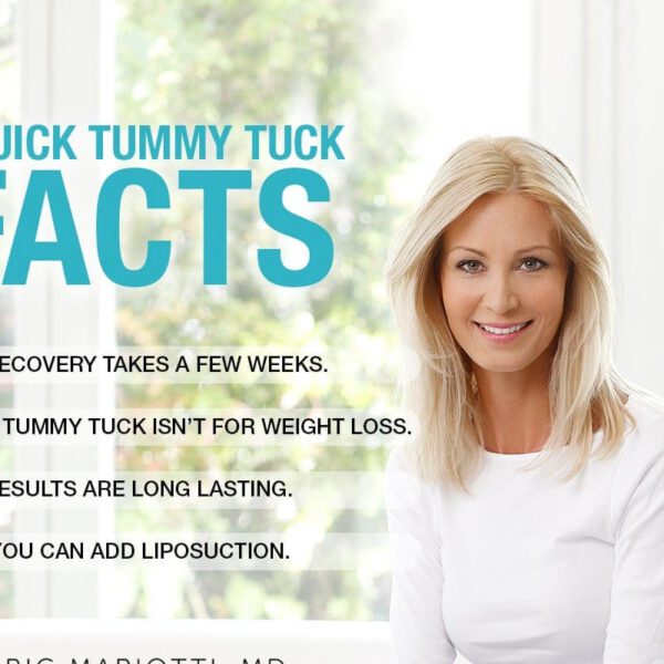 4 Quick Tummy Tuck Facts [Infographic]
