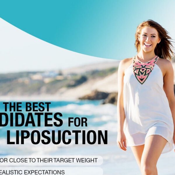 The Best Candidates for Liposuction [Infographic]