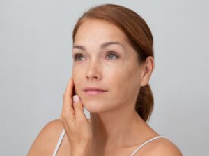 freckled woman